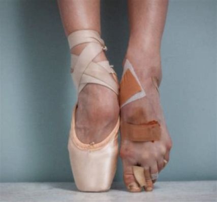 do ballet dancers have bad feet